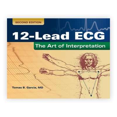 12-Lead ECG: The Art of Interpretation