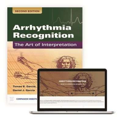 Arrhythmia Recognition: The Art of Interpretation